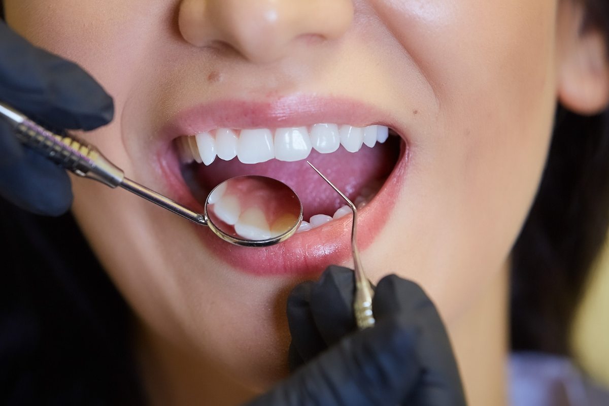 덴티오클린 부작용 모르면 손해보는 복용방법