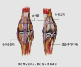 강아지 슬개골 탈구 수술 후유증_2