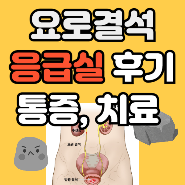 요로결석