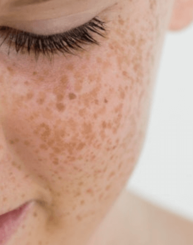 썬크림(자외선 차단제) 알아보기