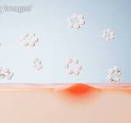 화장품성분중 여드름 유발