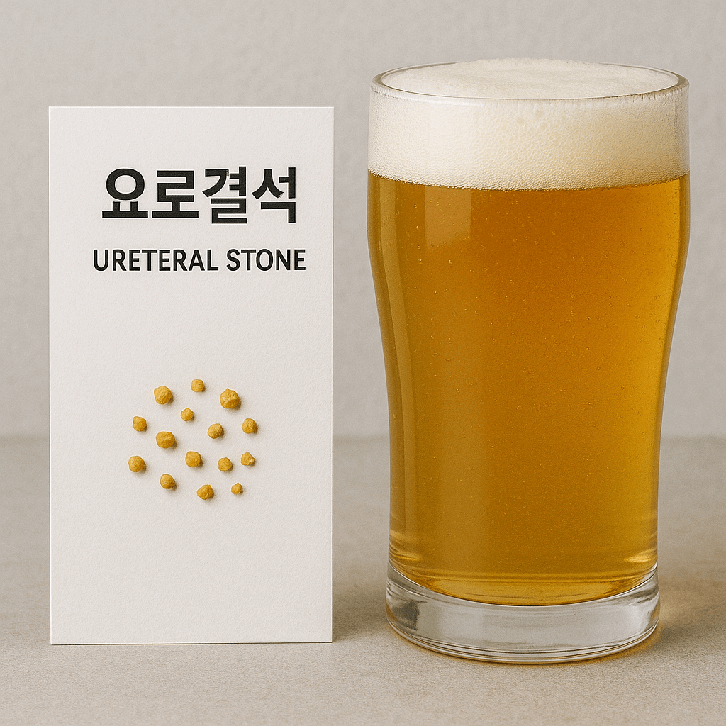 요로결석과 맥주 이미지