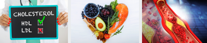 콜레스테롤