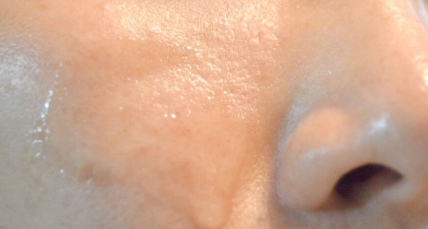 모공 관리로 인해 모공이 줄어든 모습