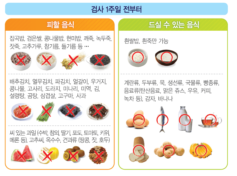 대장내시경 전 식이조절 음식