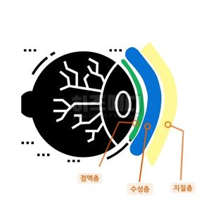 안구 건조증 증상