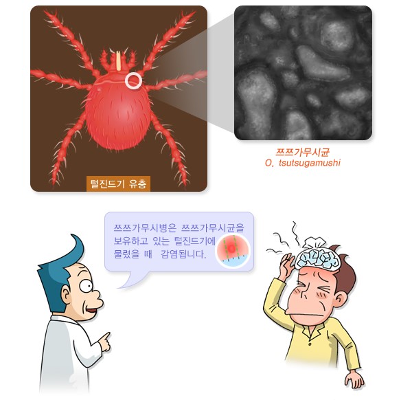 쯔쯔가무시병 감염