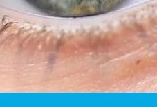 눈 영양제 구매 전 필수 정보 3가지&amp;#44; 루테인만 먹으면 안 되는 이유