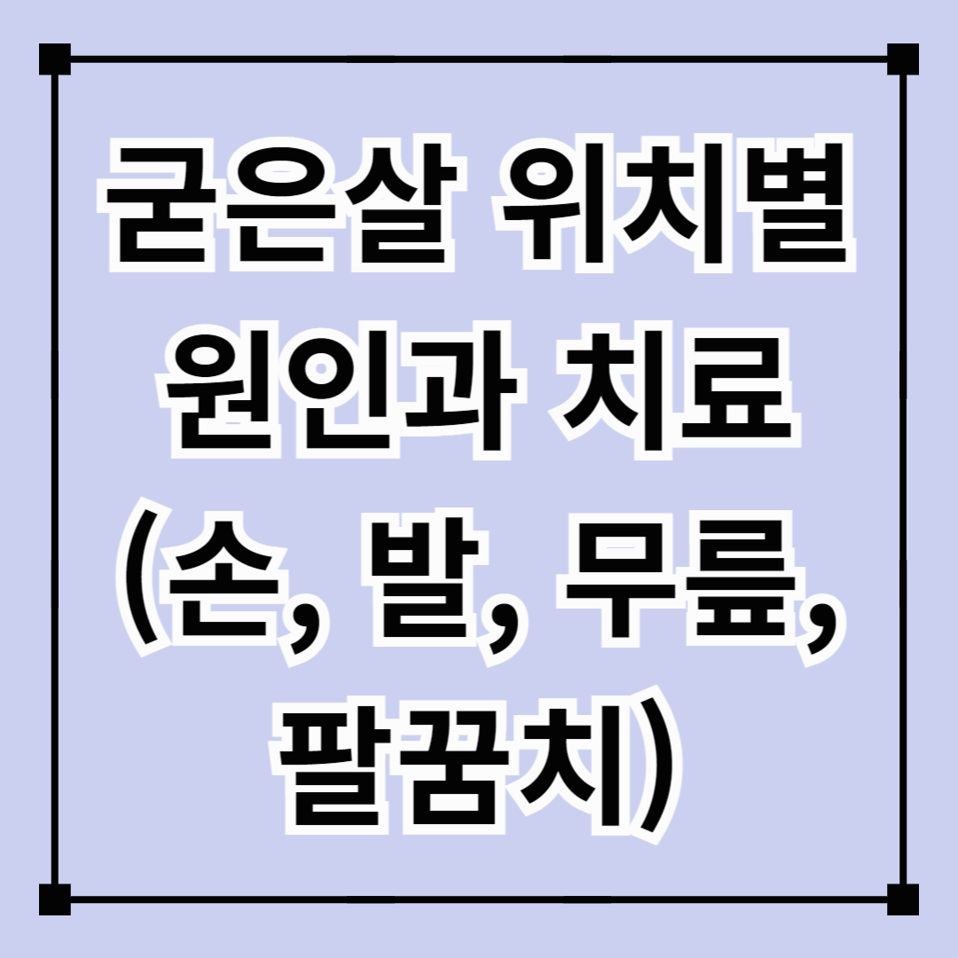 굳은살 위치별 원인과 치료 (손, 발, 무릎, 팔꿈치)