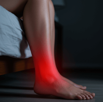 발목 통풍 응급 대처법2