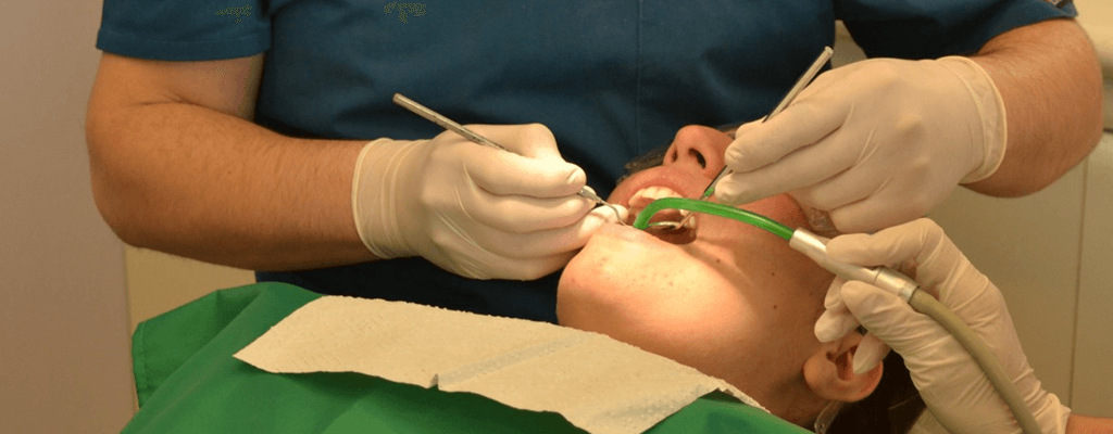 주기적인 치아 스케일링 예시