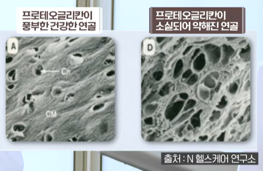 프로테오글리칸