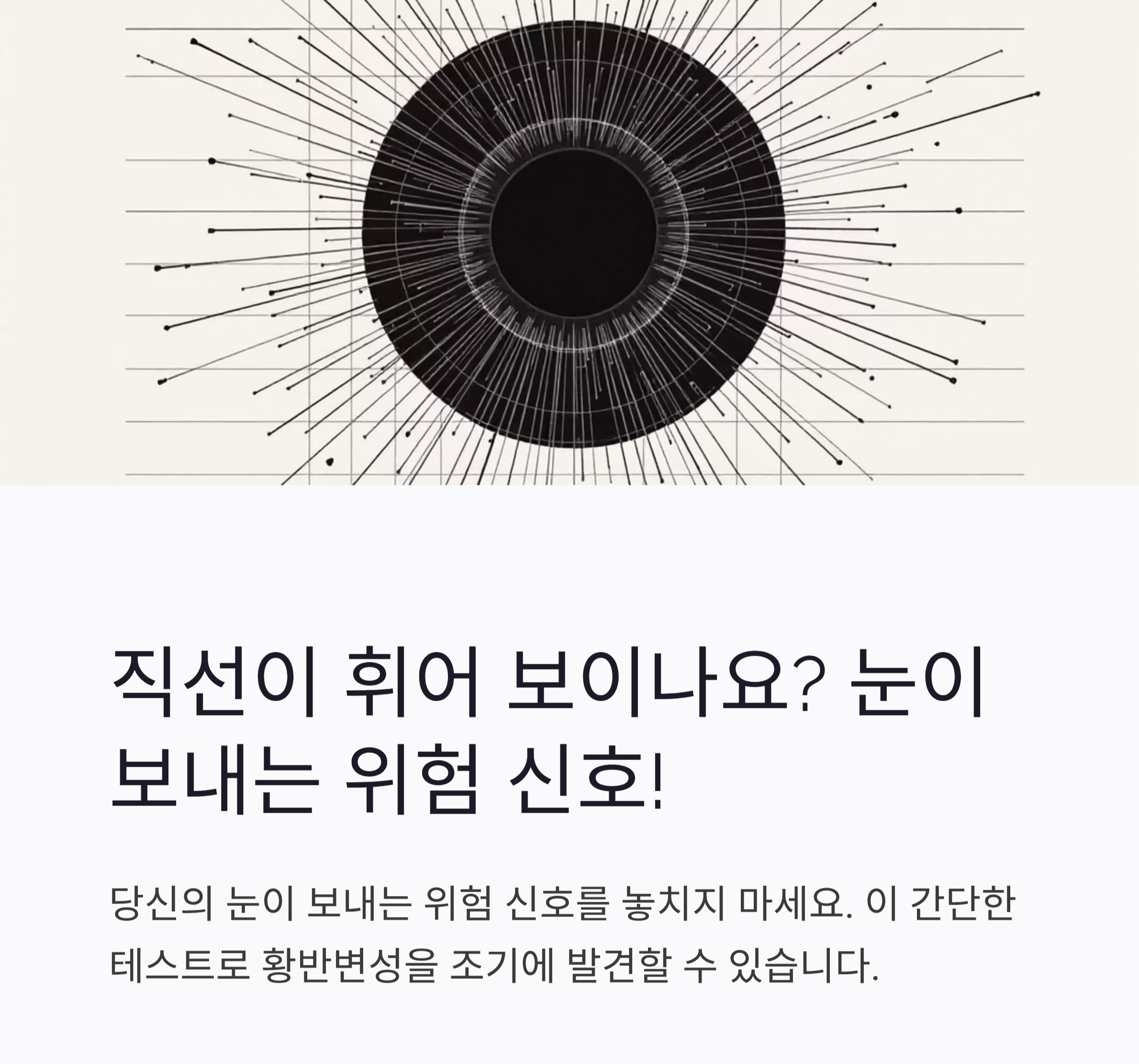 (황반변성)
