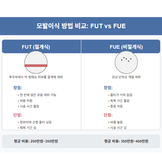 모발이식 방법 비교 차트