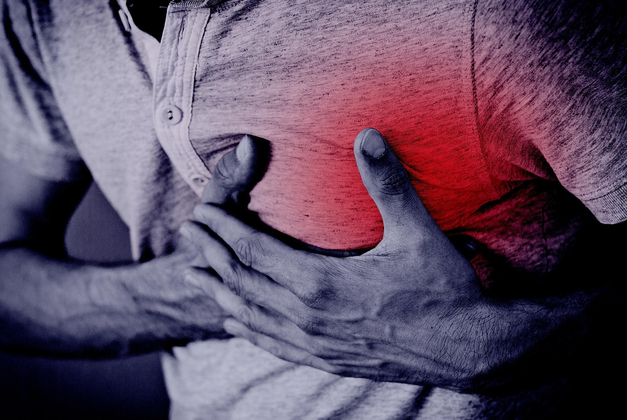 심근경색 관련사진