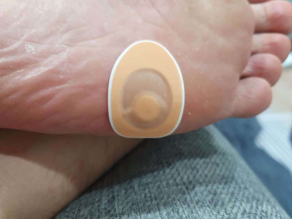 티눈밴드 발바닥에 붙인사진