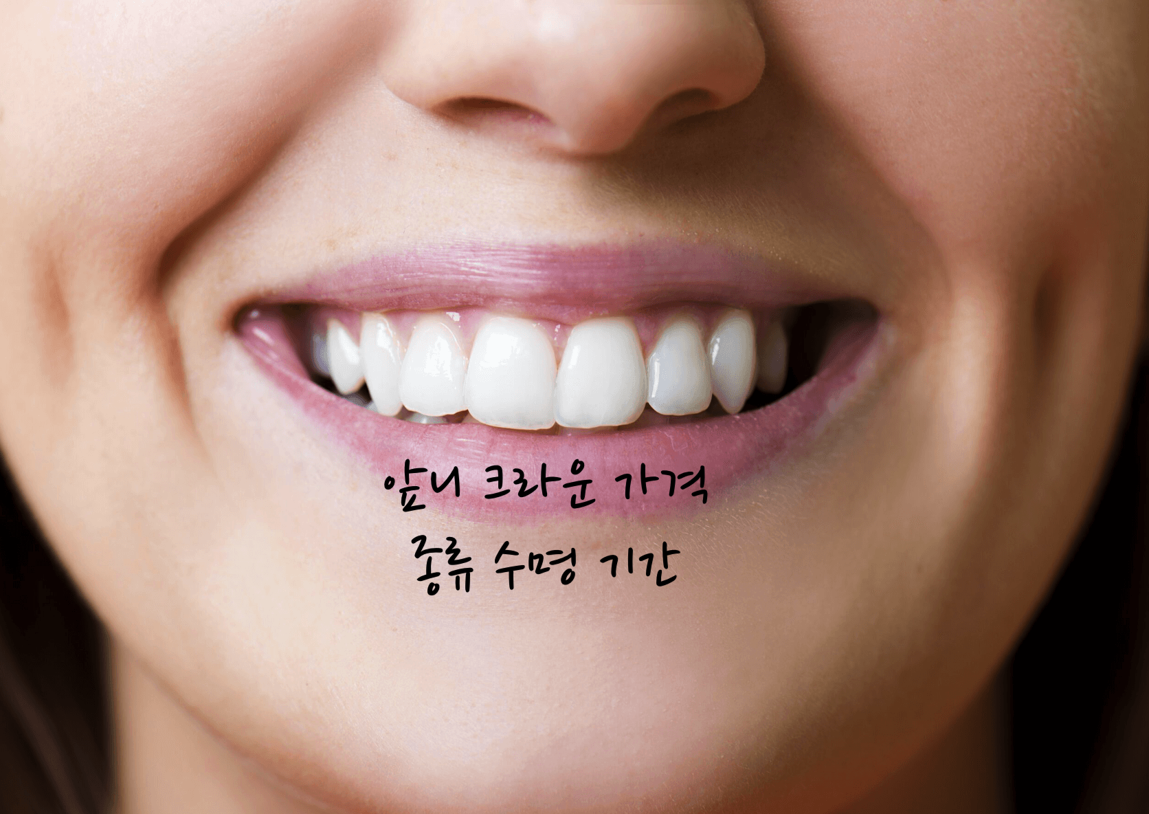 앞니 크라운