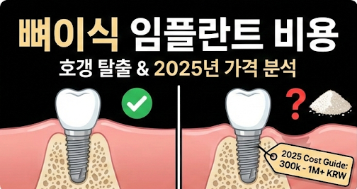 뼈이식 임플란트 비용