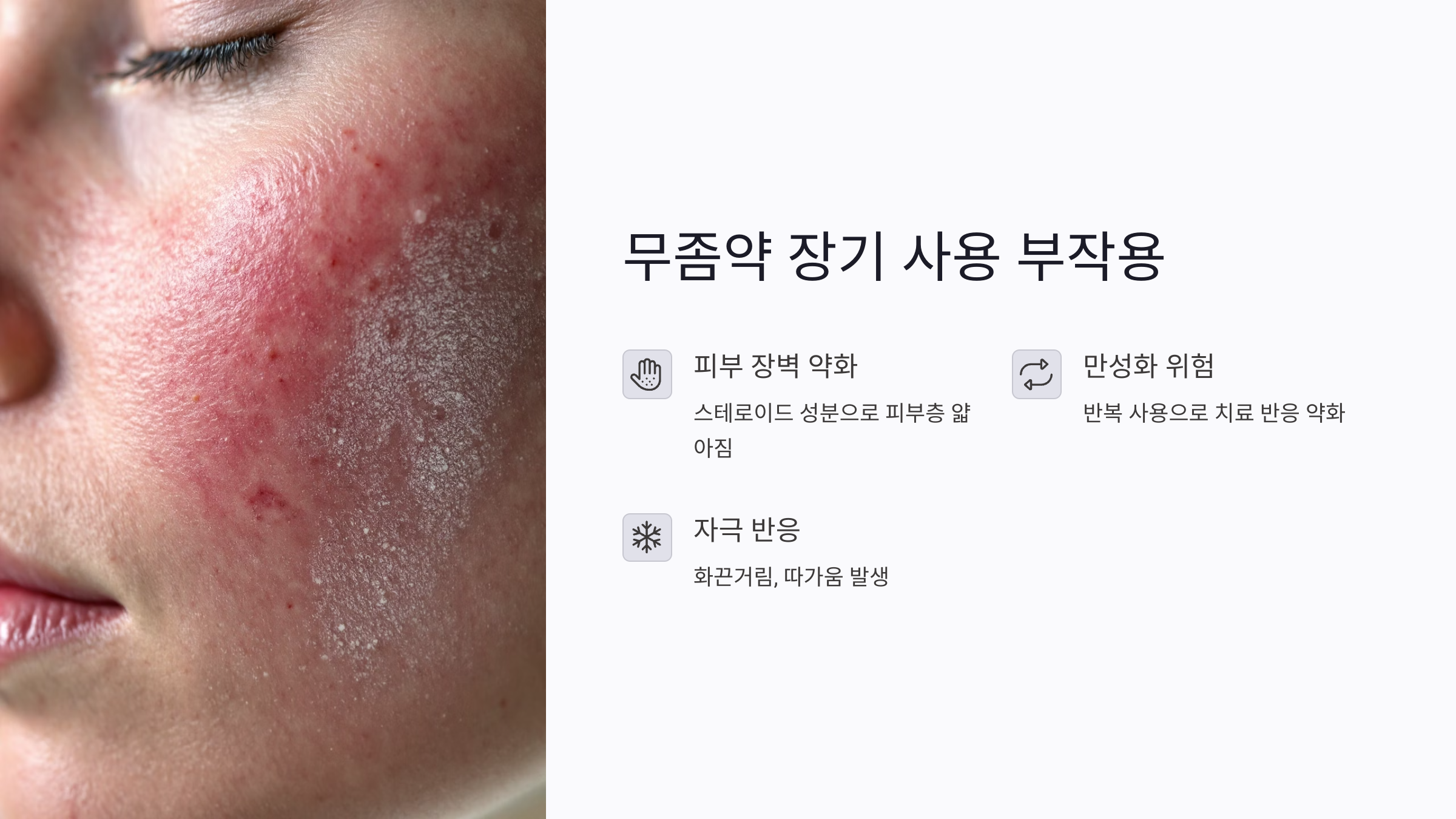 무좀약 사용기간과 끊는 시점 총정리: 장기 사용 부작용부터 안전한 치료법까지