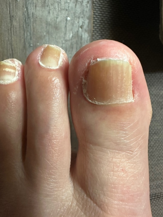 집에서 꾸준히 관리하는 방법