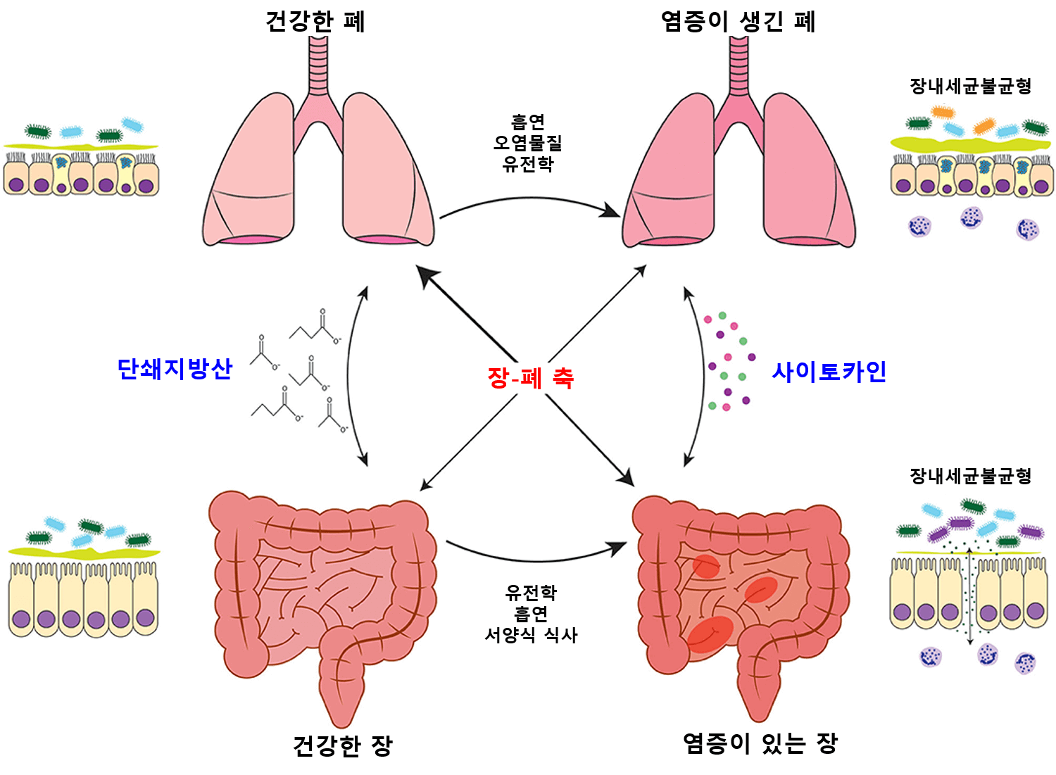 마이크로바이옴