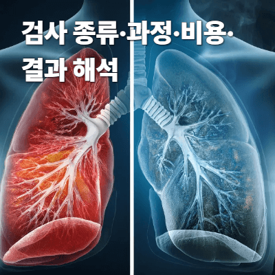 폐기능 검사 총정리 (2025)|검사 종류·과정·비용·결과 해석