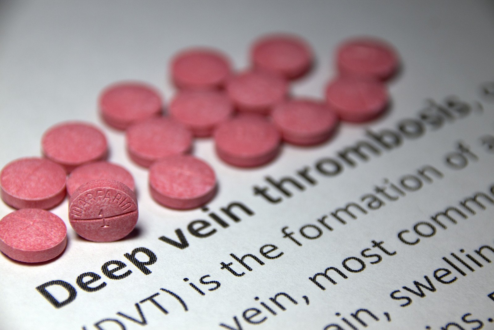 심부정맥혈전증(DVT, Deep Vein Thrombosis) &ndash; 다리 정맥에 발생하는 혈전