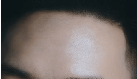 모공 줄이는 방법 - 꿀