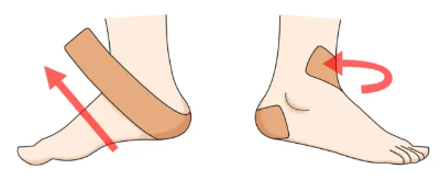 발 테이핑 방법