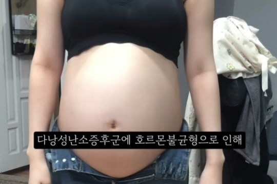36주된 태아 낙태 브이로그 올린 여성 유튜버