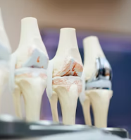 통풍 치료법 진단 기준 합병증