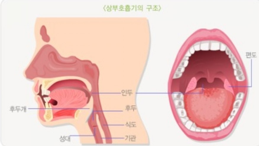 목구멍이 아플때 예방법과 가정요법-동의보감 인후통