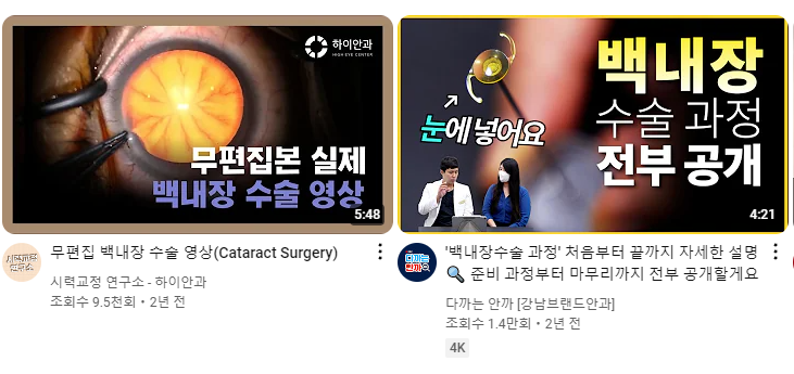 백내장 수술 영상