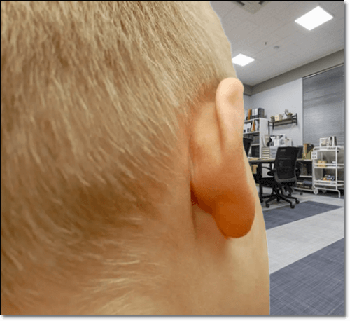 귓볼몽우리 남자