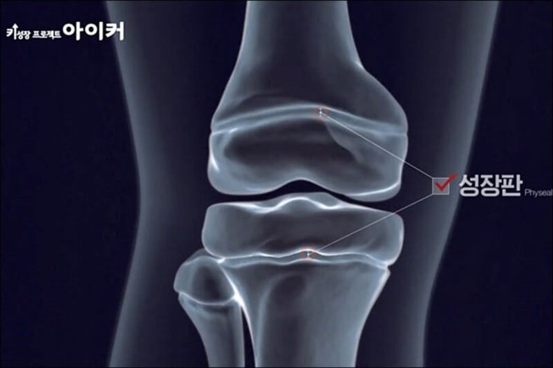 종근당 아이커 가격 및 효과