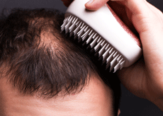 로게인폼 가격&amp;#44; 직구&amp;#44; 약국&amp;#44; 효과&amp;#44; 사용법