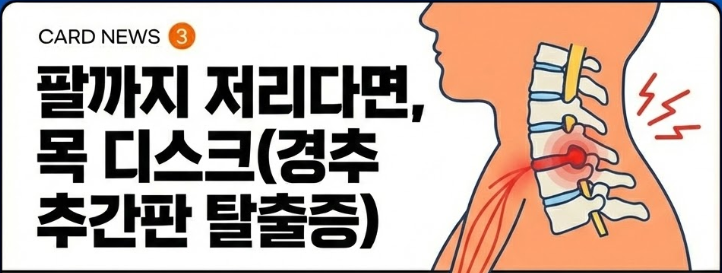 팔까지 저리다면, 목 디스크(경추 추간판 탈출증)