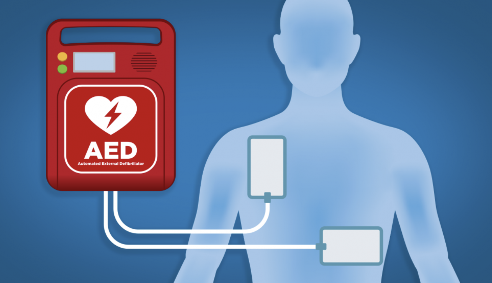 자동심장충격기(AED) 위치와 사용법