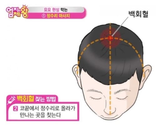 백회혈찾는방법2