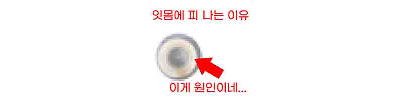 치실에서 피, 냄새 나는 이유 (치실 고르는 방법과 사용 방법)