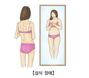 섭식장애