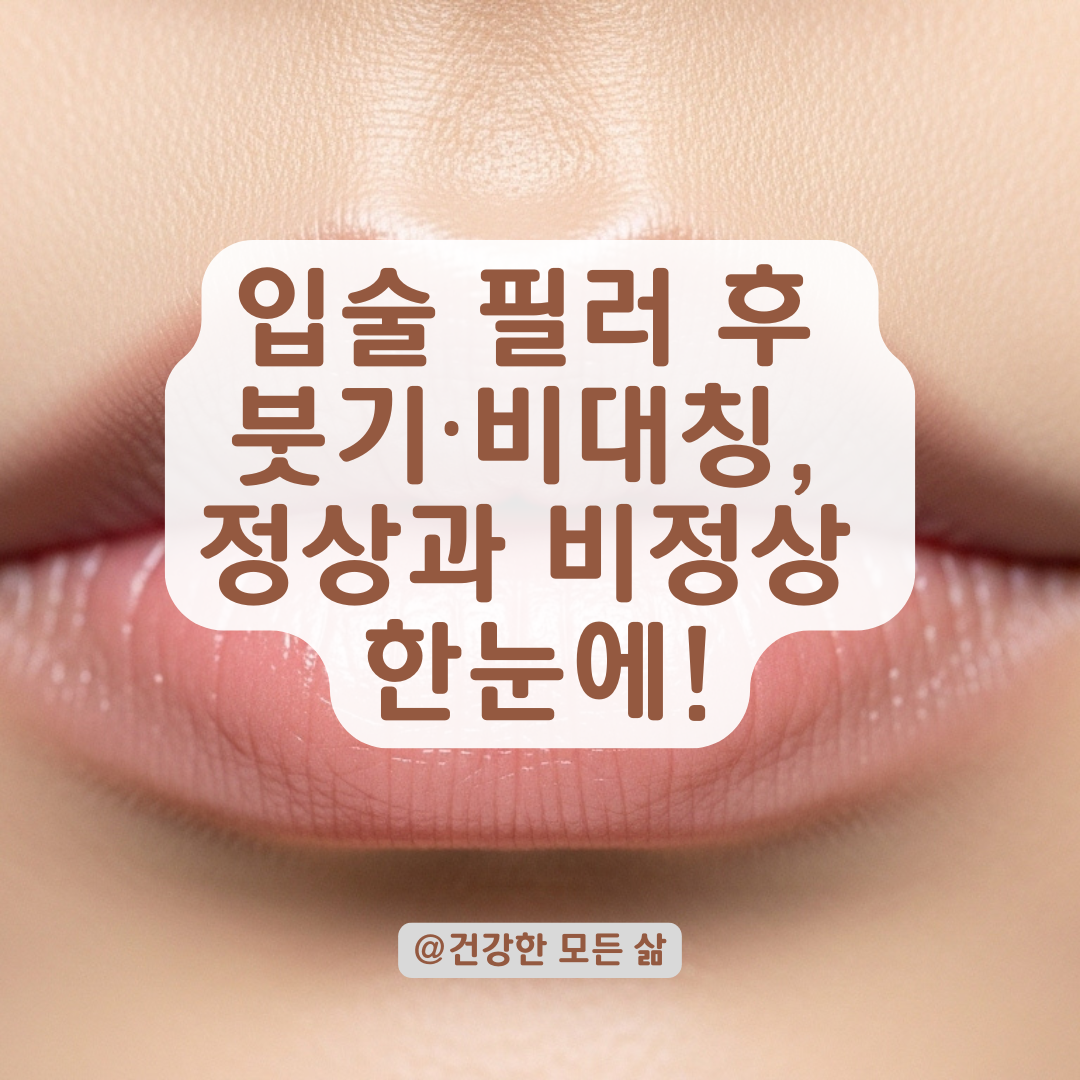 입술 필러 후 비대칭, 뭉침, 붓기증상 정상 범위 구별법과 비정상 대처 방법 총정리.
