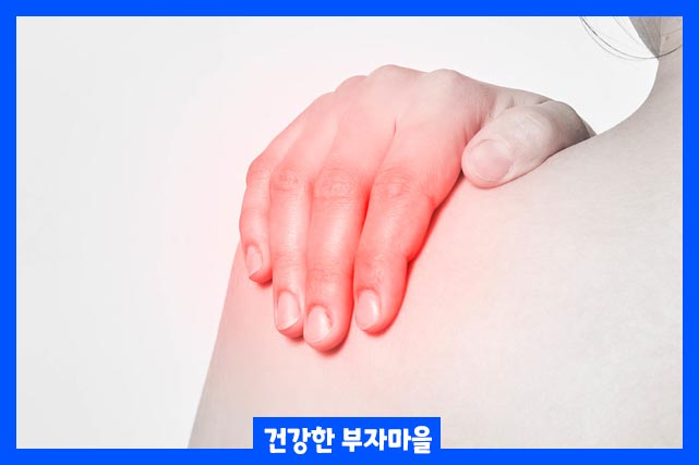 어깨부위를 과도하게 사용했을 때 어깨 충돌증후군이 생기는 원인