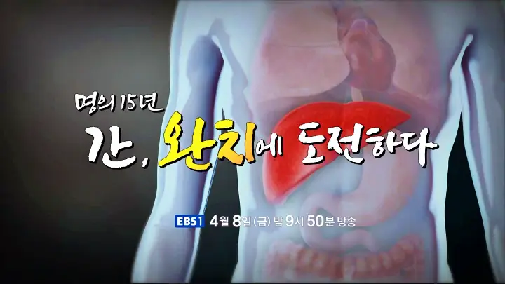 명의 간이식 간암 알프스수술 간경변 간암 간경화 간염 바이러스 전문의 서경석 김기훈 임영석 교수 진료 예약 소개