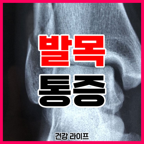 발목 통증