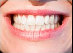 잇몸이 붓는 이유 8