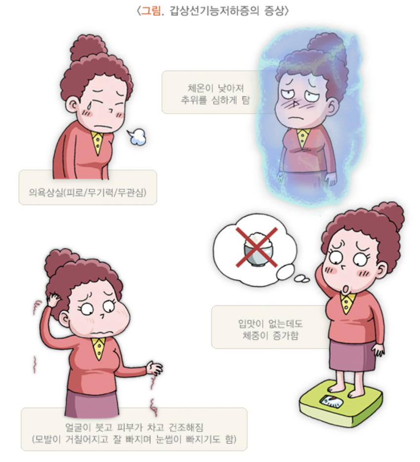 갑상선기능저하증 증상