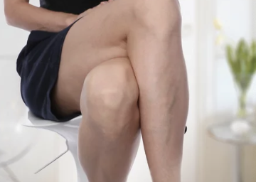 하지정맥류의 주요 증상