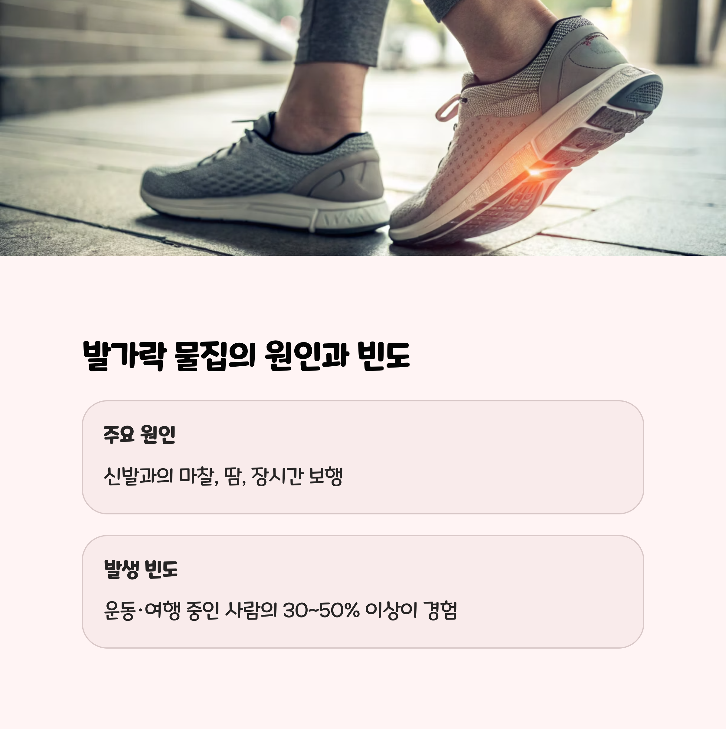 발가락 물집, 왜 생기고 얼마나 흔한가요?