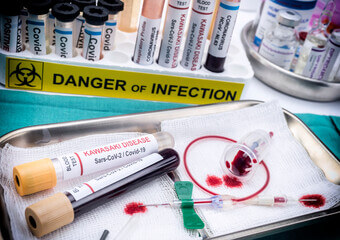 가와사키병 증상 및 원인&amp;#44; 치료와 예방방법을 알아봤습니다. 가와사키병은 아이가 갑자기 이유 없이 고열에 시달리면서 시작되는 질병입니다. 어떤 질환인지 꼼꼼히 읽어 보시기 바랍니다. 